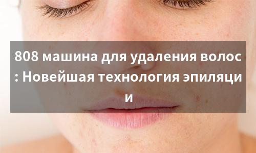 808 машина для удаления волос: Новейшая технология эпиляции